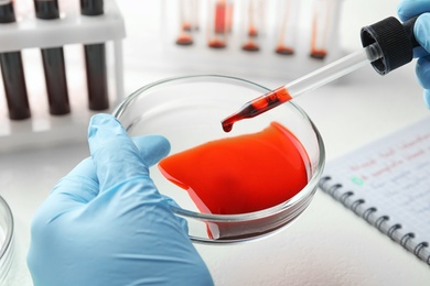 Scientist dripping blood from pipette into Petri dish at table, closeup. Laboratory analysis