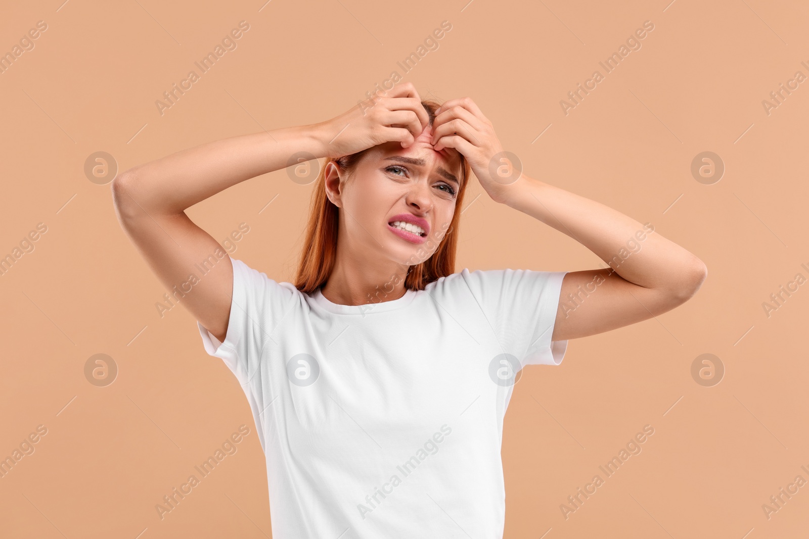 Photo of Suffering from allergy. Young woman scratching her face on beige background