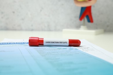 Photo of Liver Function Test. Tube with blood sample and forms on table