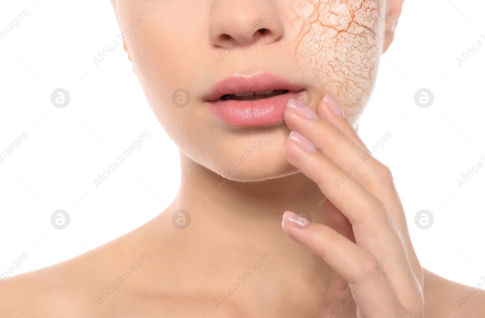 Image of Beautiful young woman with dry skin on white background, closeup