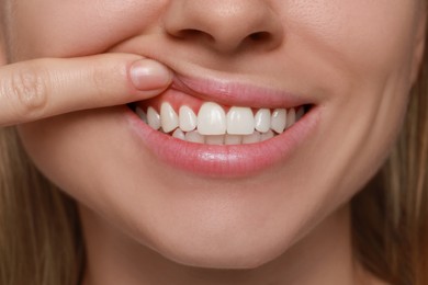 Photo of Young woman showing healthy gums, closeup view