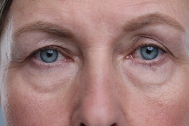 Photo of Closeup view of senior woman's face with aging skin