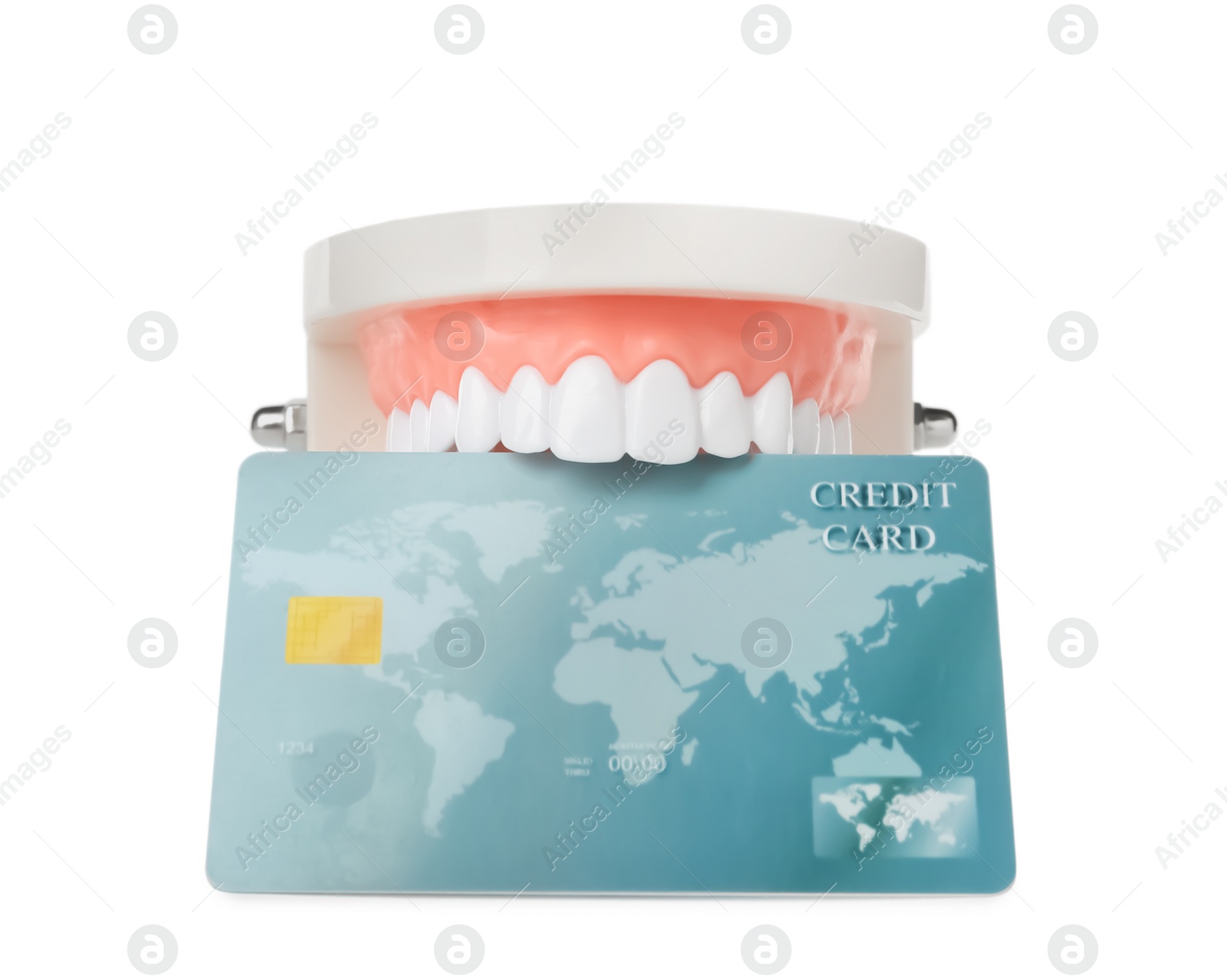Photo of Educational dental typodont model with credit card on white background. Expensive treatment