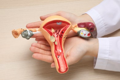 Photo of Gynecologist with anatomical model of uterus at wooden table, above view