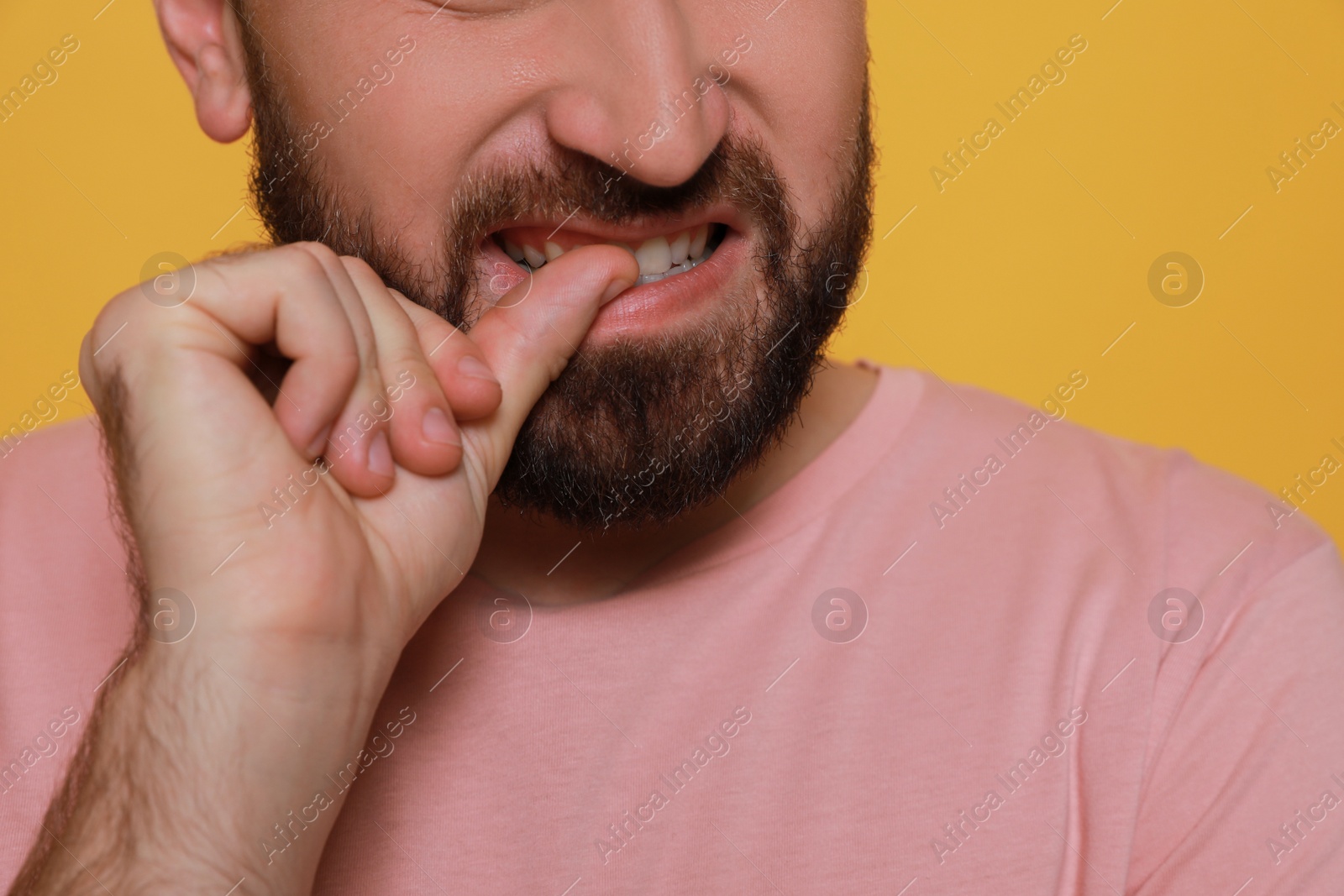 Photo of Man biting his nails on yellow background, closeup. Bad habit