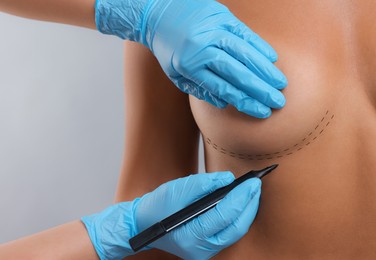 Breast augmentation. Doctor with marker preparing woman for plastic surgery operation against light grey background, closeup