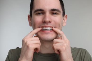 Young man applying whitening strip on his teeth against light grey background