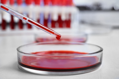 Photo of Pipetting blood into Petri dish for analysis on table in laboratory, closeup