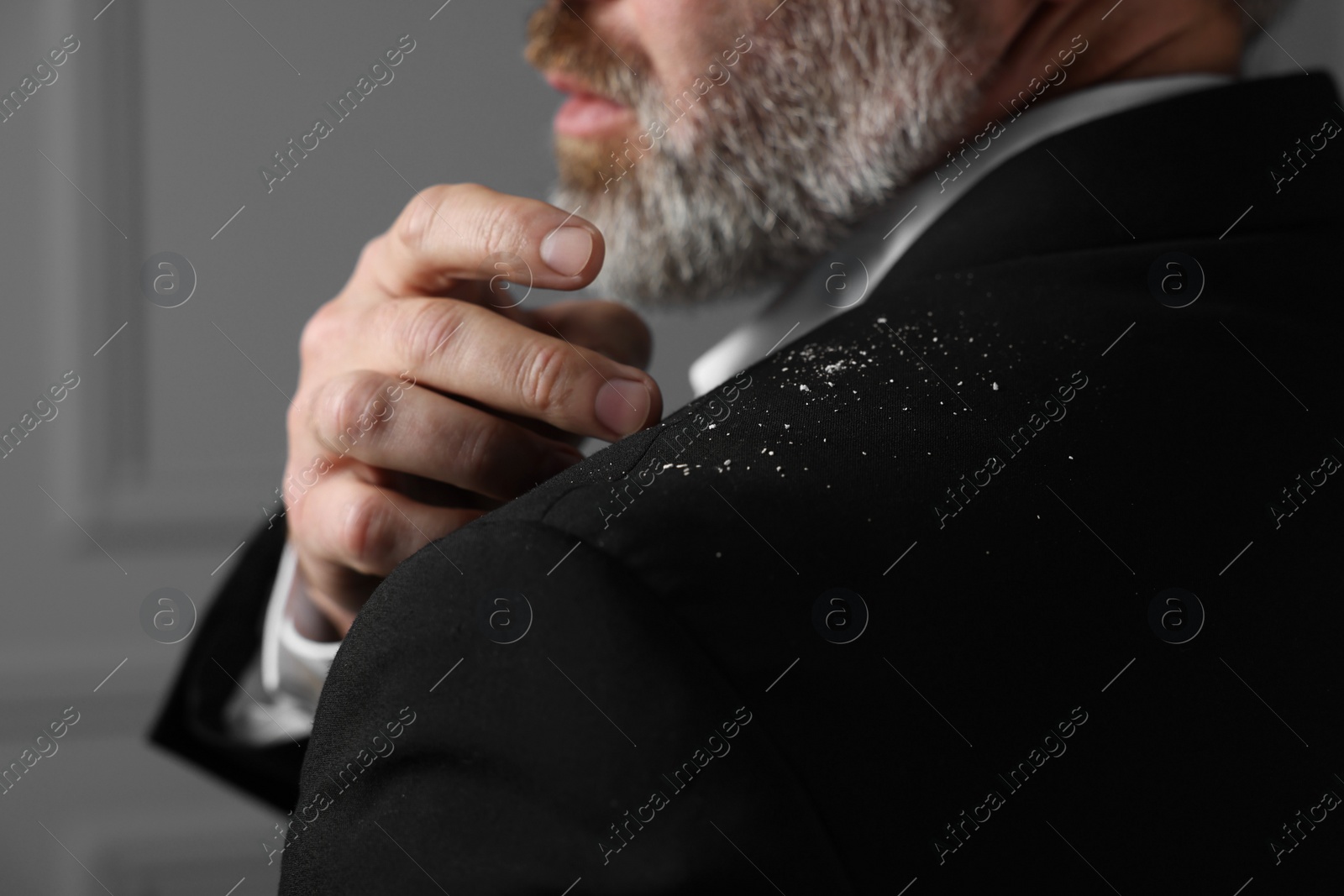 Photo of Bearded man brushing dandruff off his jacket on grey background, closeup