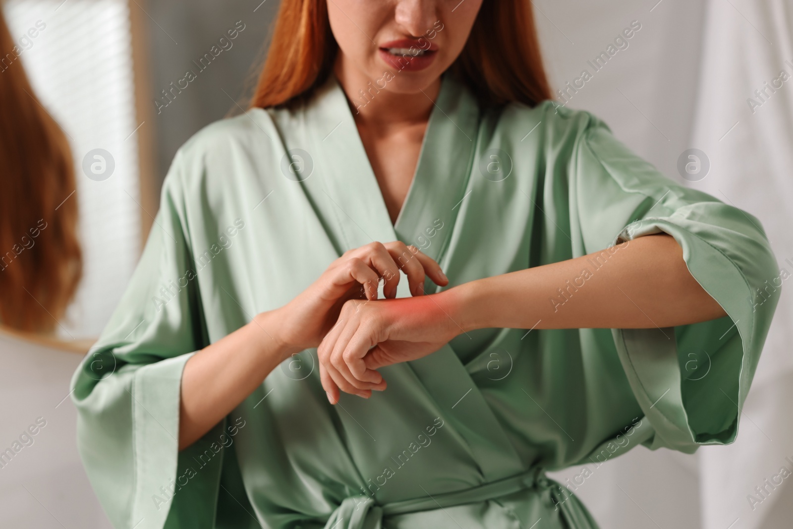 Photo of Suffering from allergy. Young woman scratching her arm in bathroom, closeup