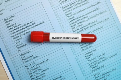 Photo of Liver Function Test. Tube with blood sample and laboratory form on table, top view