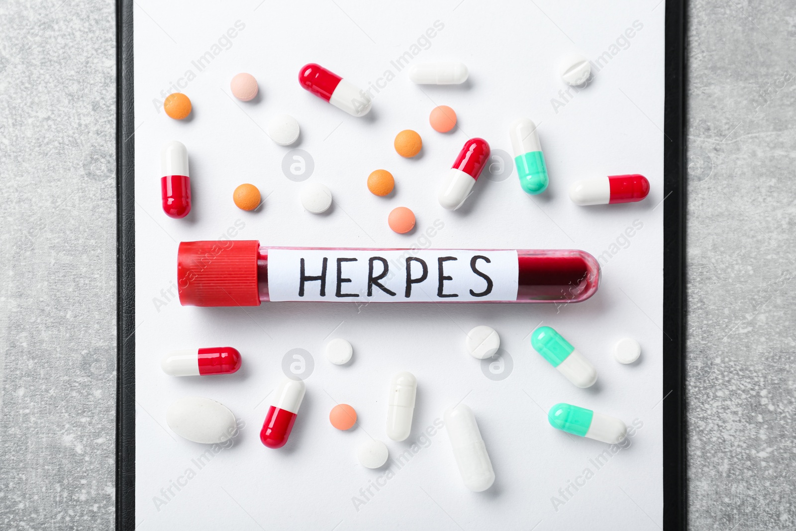 Photo of Test tube with word Herpes different pills and clipboard on light grey table, flat lay