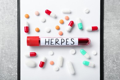 Test tube with word Herpes different pills and clipboard on light grey table, flat lay