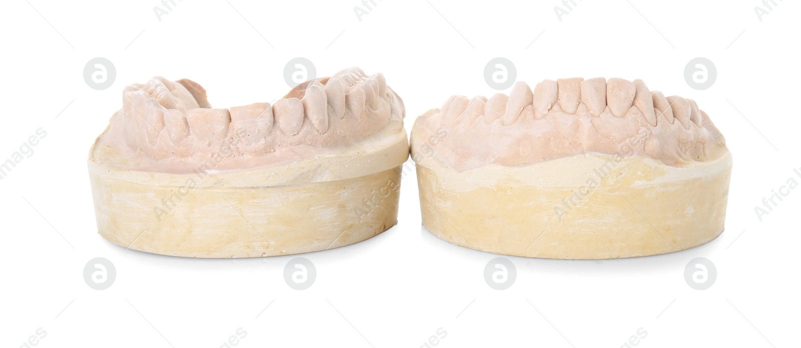 Photo of Dental model with jaws isolated on white. Cast of teeth