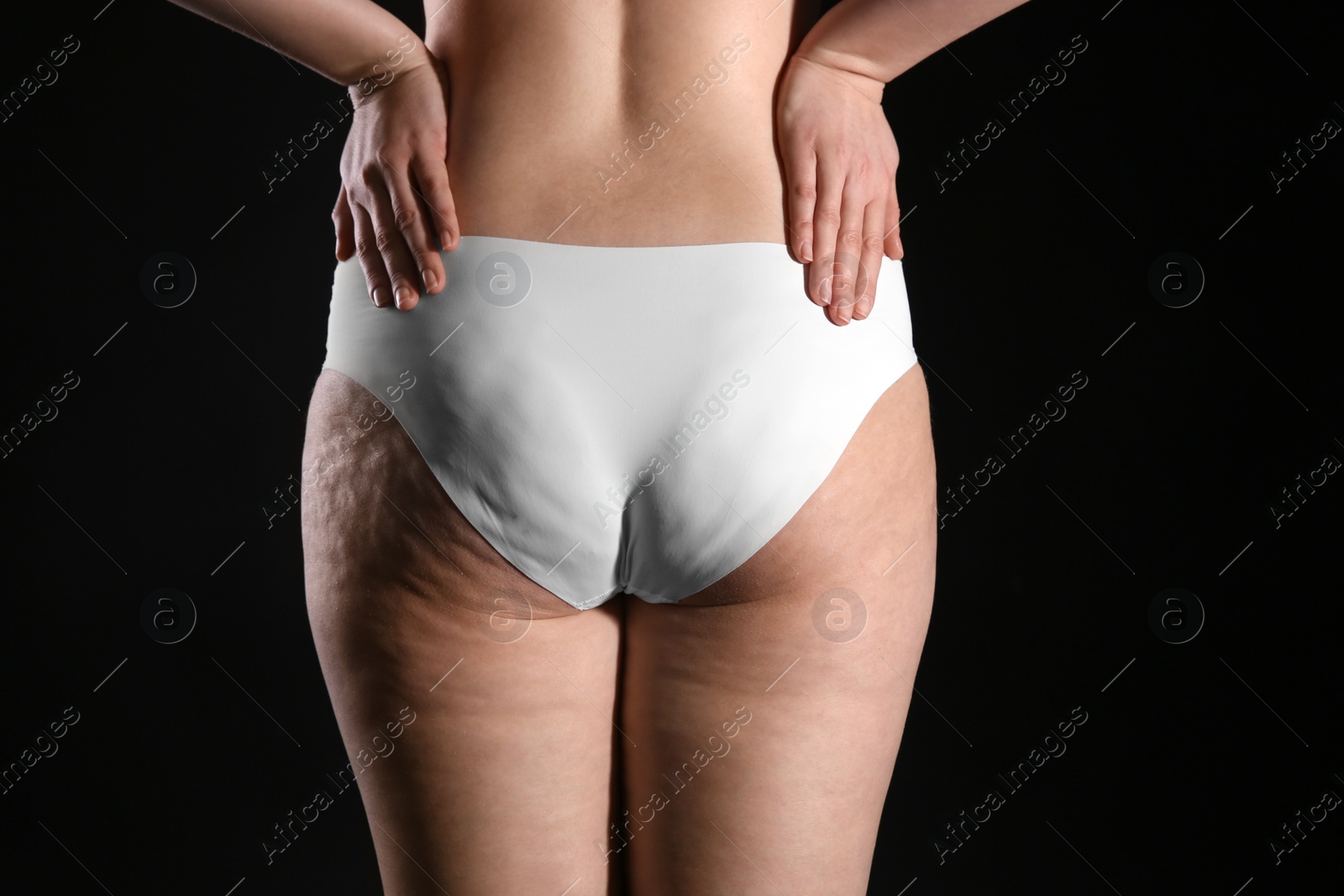 Photo of Woman with cellulite on black background, closeup