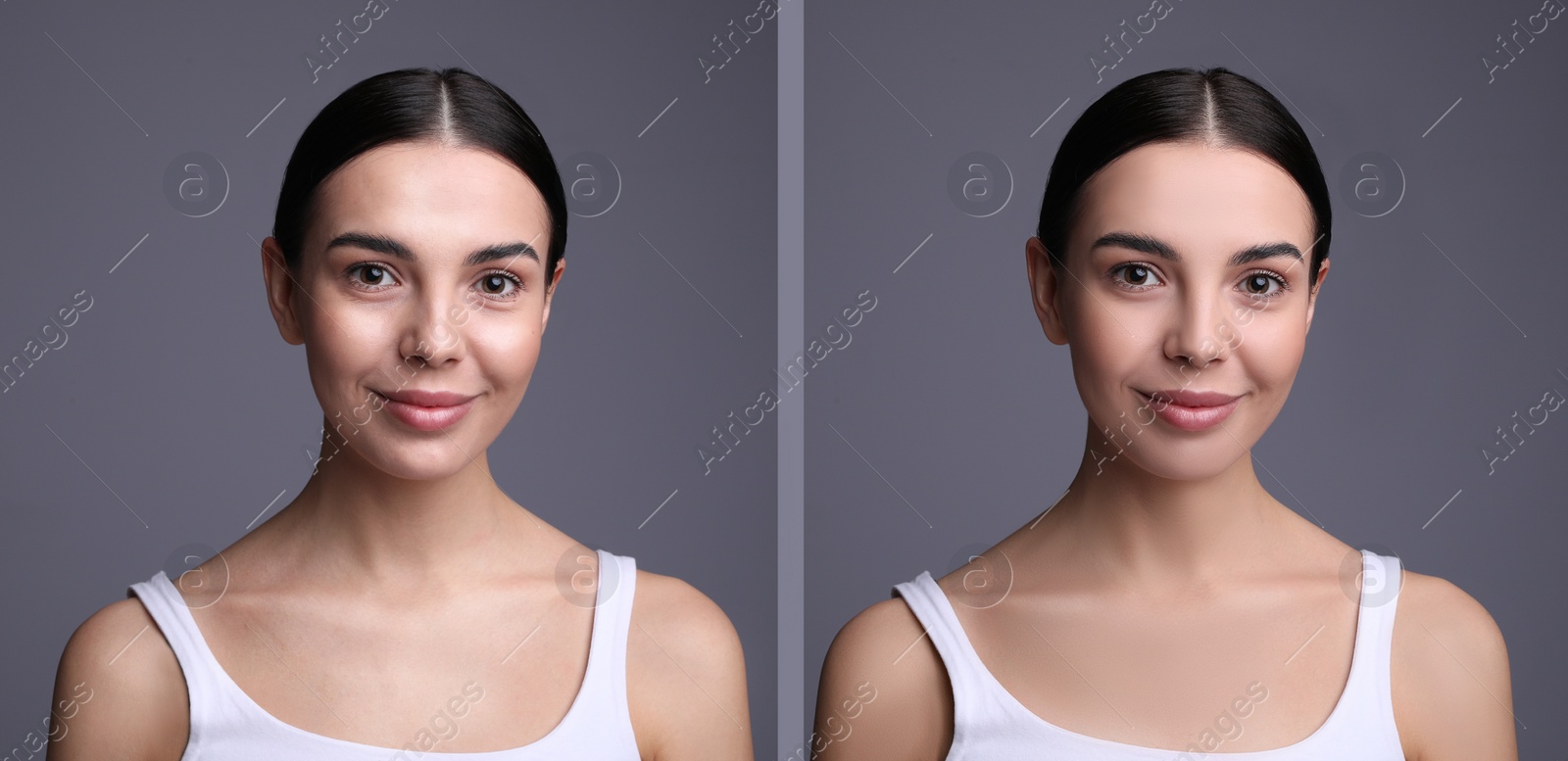 Image of Collage with photos of beautiful young woman before and after using mattifying wipes on grey background. Banner design