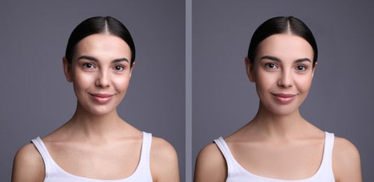 Image of Collage with photos of beautiful young woman before and after using mattifying wipes on grey background. Banner design