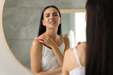 Photo of Suffering from allergy. Young woman scratching her shoulder near mirror indoors