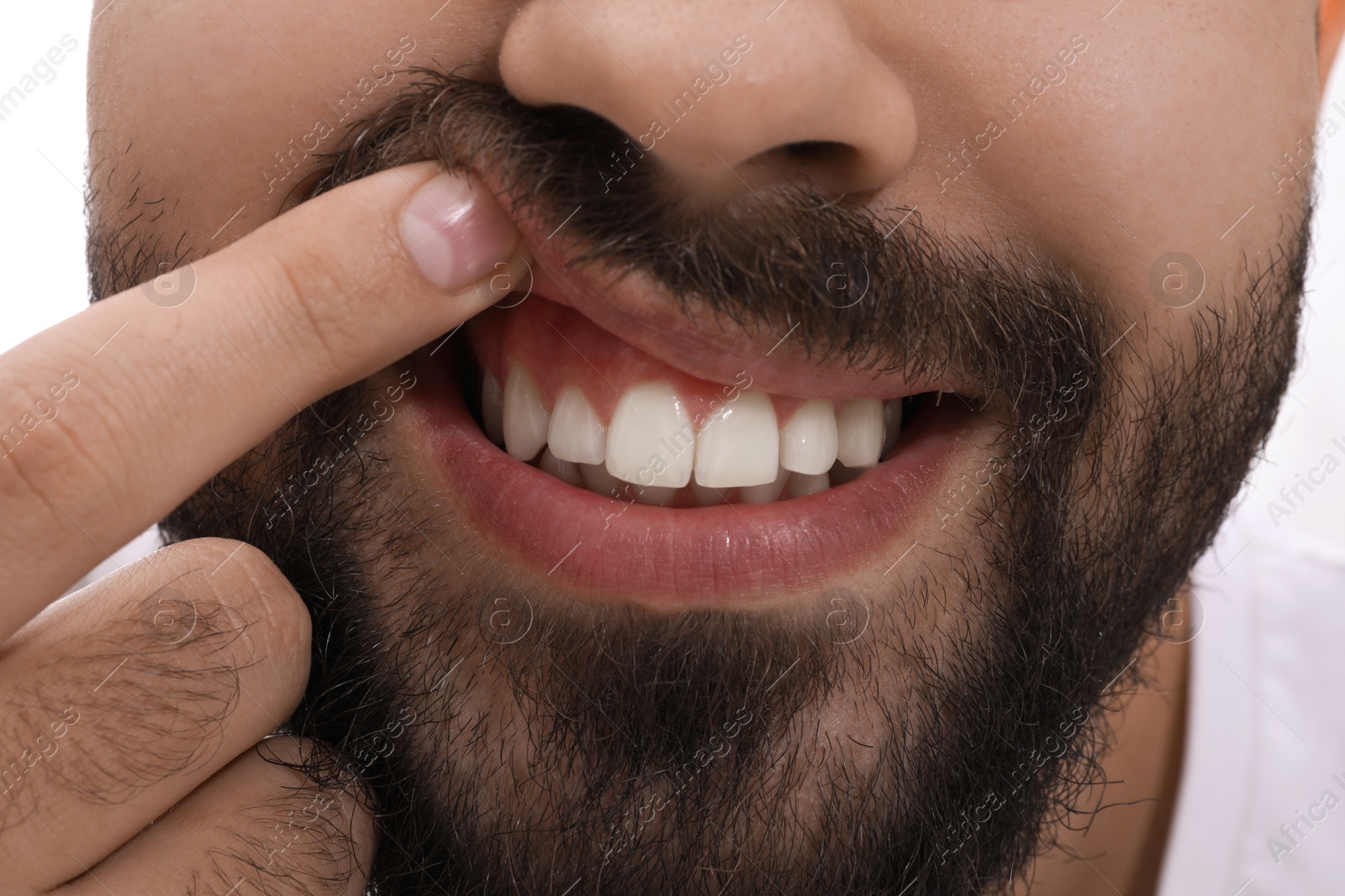 Photo of Young man showing white teeth, closeup view