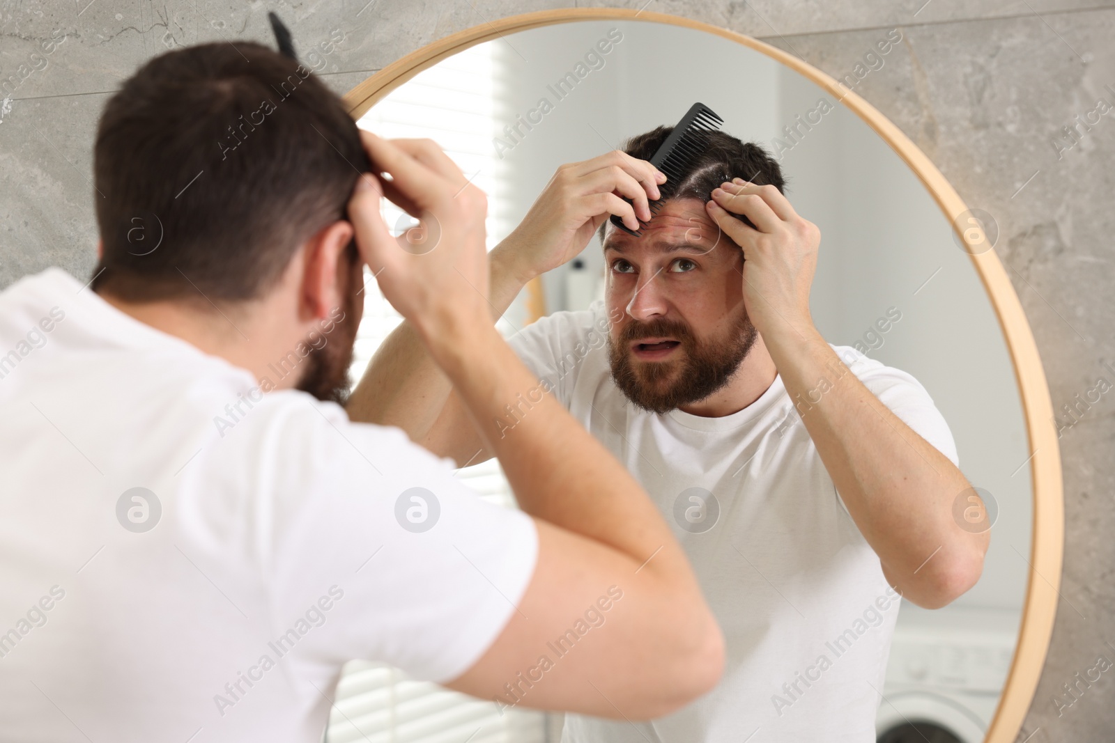 Photo of Dandruff problem. Man with comb examining his hair and scalp near mirror indoors