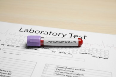 Liver Function Test. Tube with blood sample and laboratory form on wooden table