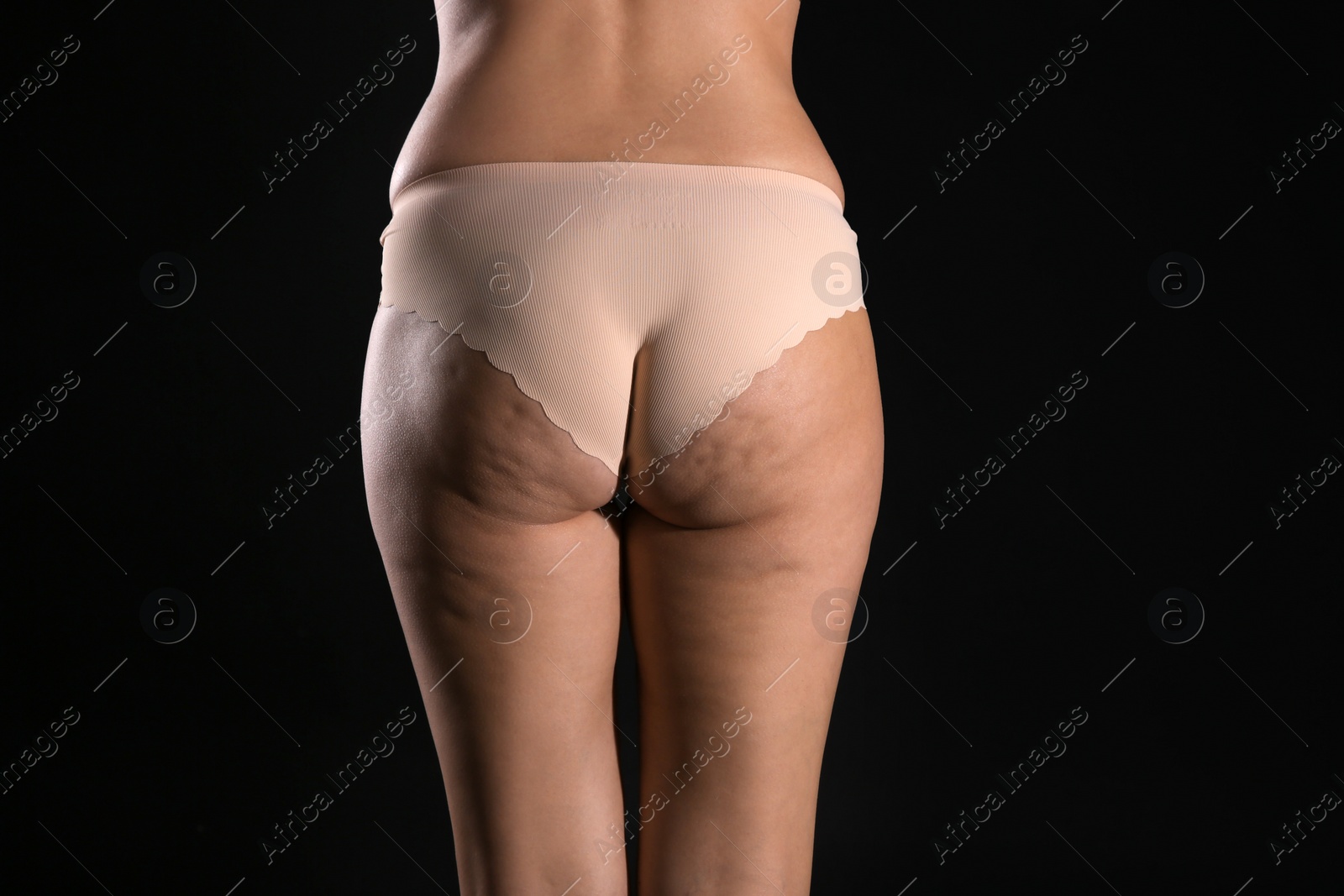 Photo of Woman with cellulite on black background, closeup