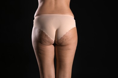 Photo of Woman with cellulite on black background, closeup