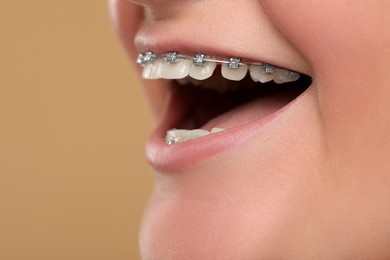 Photo of Happy woman with dental braces on brown background, closeup. Space for text