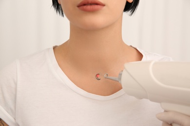 Photo of Young woman undergoing laser tattoo removal procedure in salon, closeup