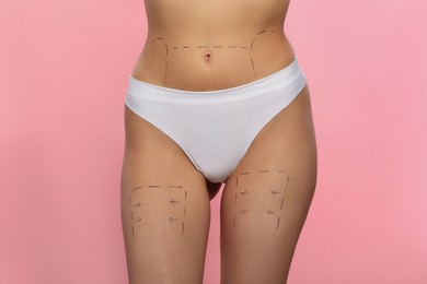 Slim woman with markings on body before cosmetic surgery operation on pink background, closeup