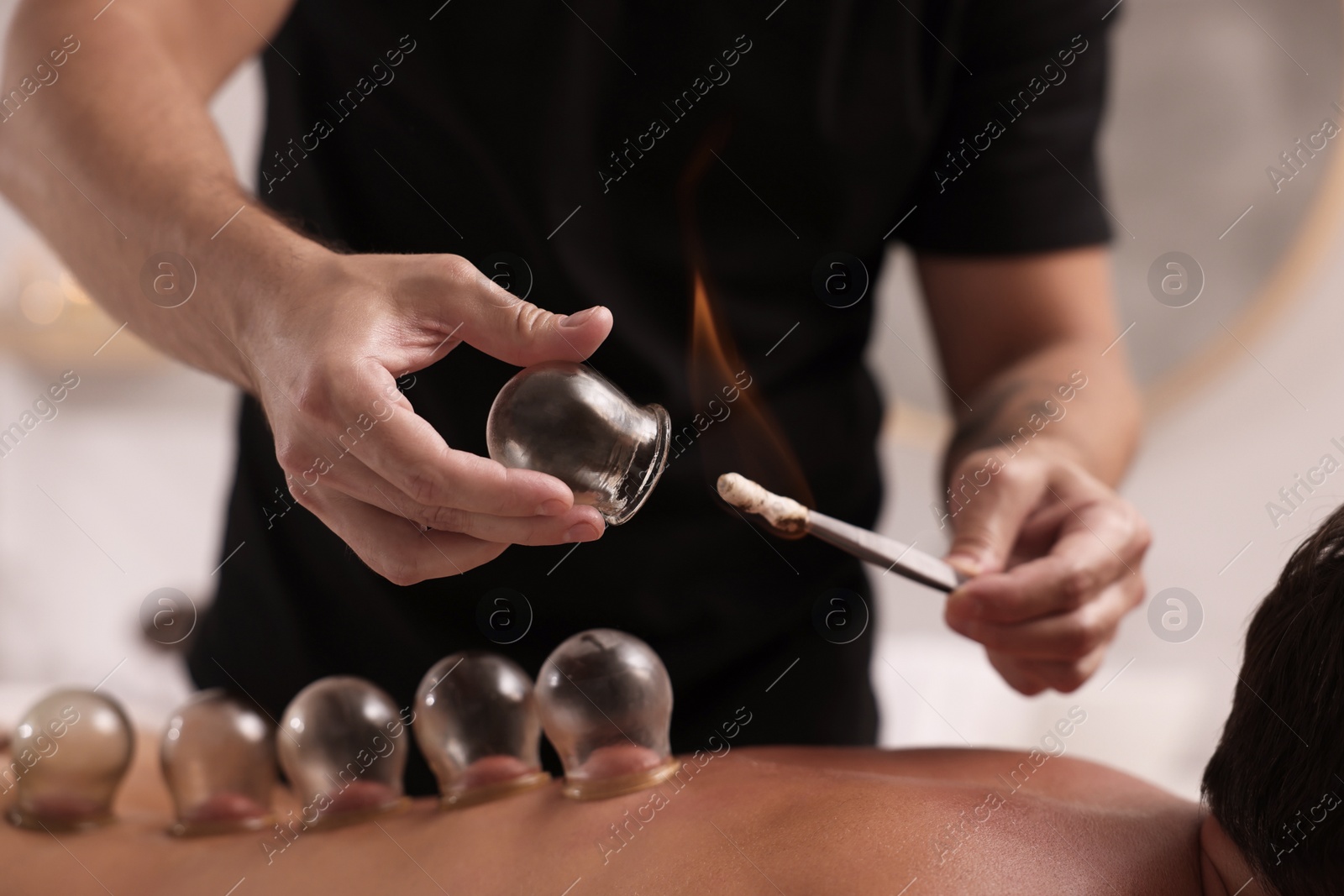 Photo of Therapist giving fire cupping treatment to patient indoors, closeup