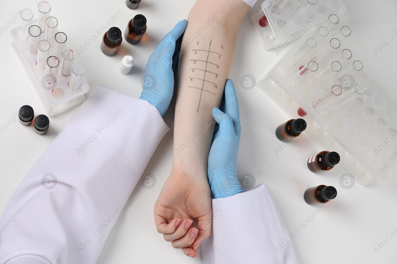 Photo of Doctor doing skin allergy test at light table, top view