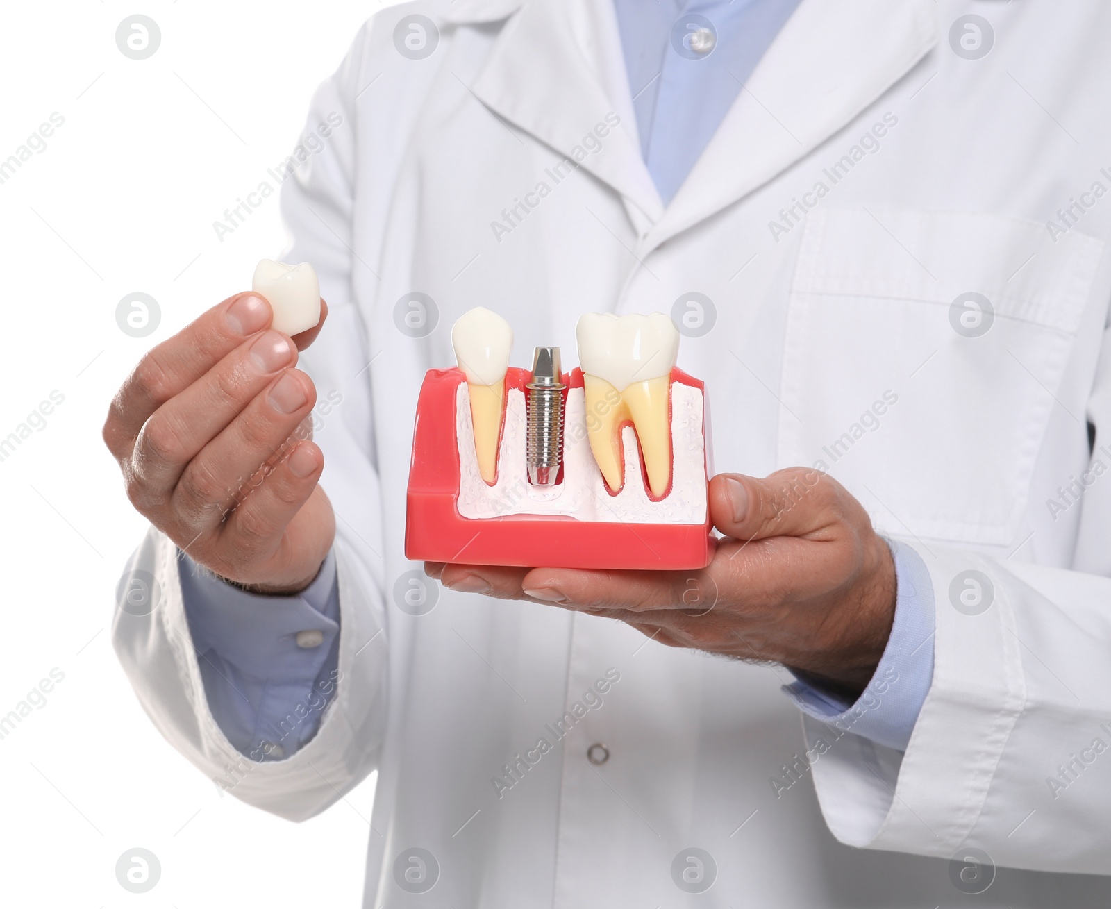 Photo of Dentist holding educational model of dental implant on white background, closeup