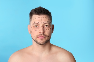 Man with marks on face for cosmetic surgery operation against blue background