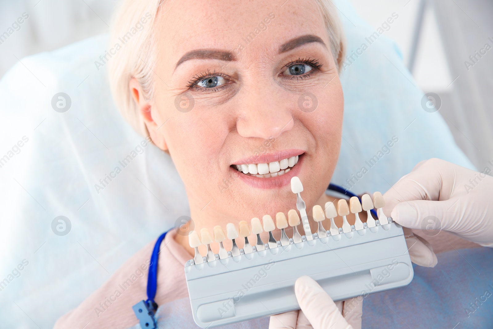 Photo of Dentist selecting patient's teeth color with palette in clinic