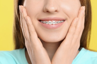Photo of Smiling woman with dental braces on yellow background, closeup