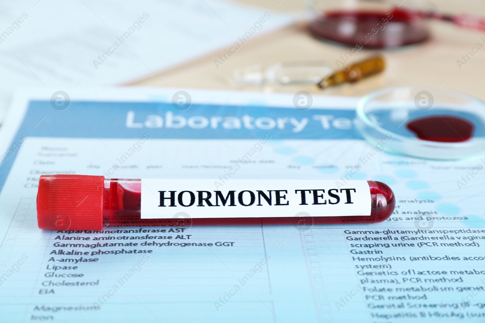 Photo of Hormones test. Sample tube with blood on laboratory form, closeup