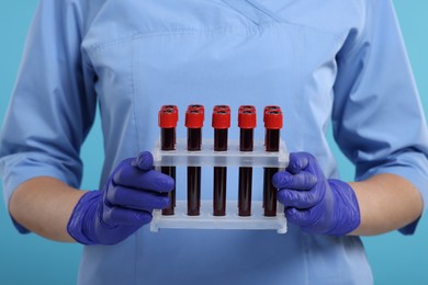 Laboratory testing. Doctor with blood samples in tubes on light blue background, closeup