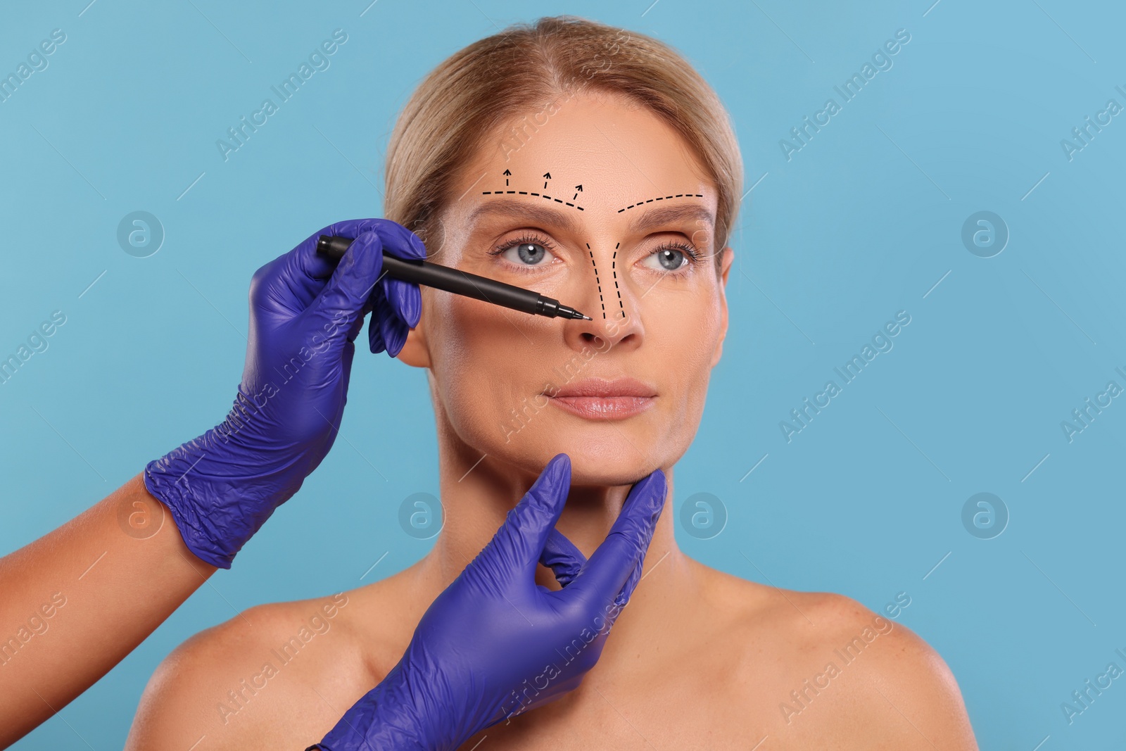 Image of Woman preparing for cosmetic surgery, light blue background. Doctor drawing markings on her face, closeup