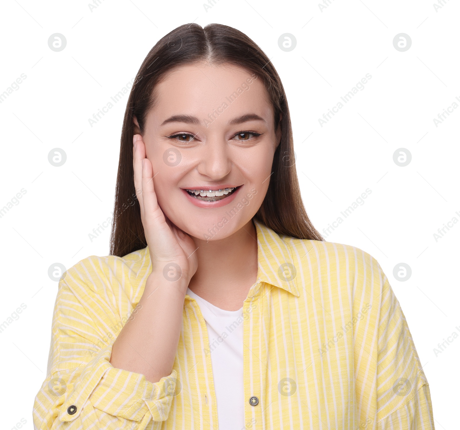 Photo of Smiling woman with dental braces on white background