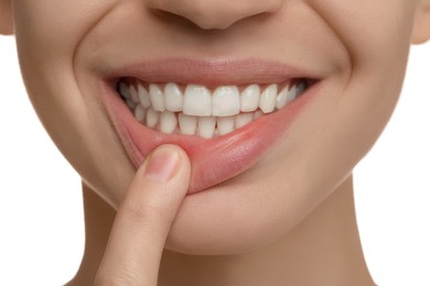 Photo of Woman with healthy teeth on white background, closeup