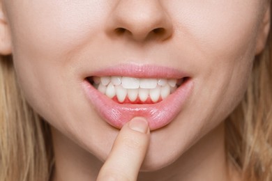 Image of Woman showing inflamed gum, closeup. Oral cavity health