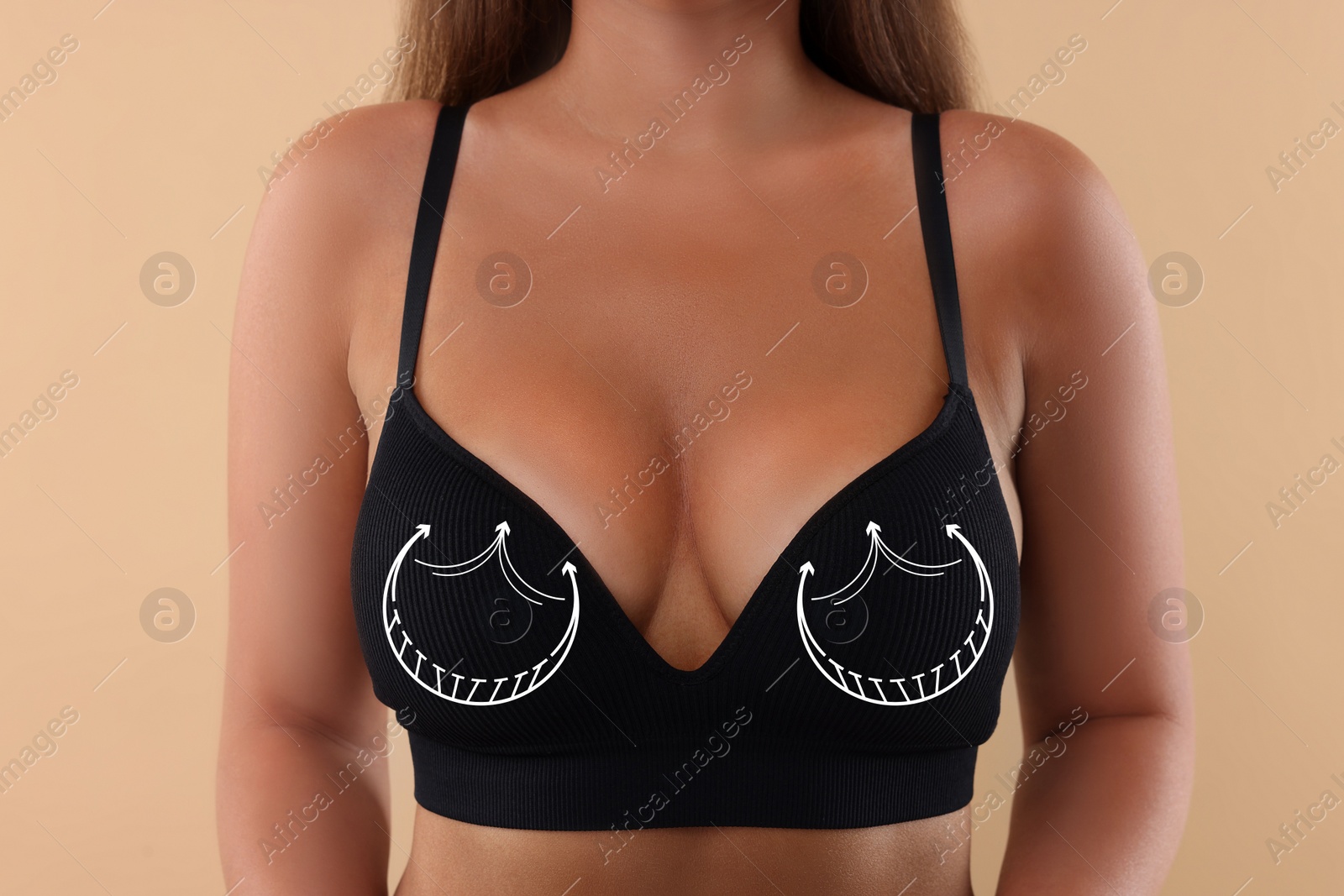 Image of Breast surgery. Woman with markings on bra against beige background, closeup