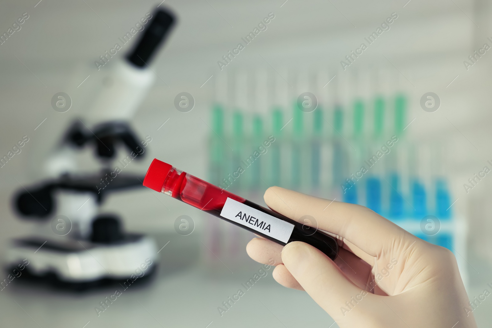 Photo of Scientist holding test tube with blood sample and label Anemia on blurred background, closeup