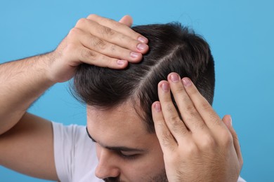 Photo of Man examining his head on light blue background, closeup. Dandruff problem