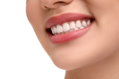 Photo of Woman with clean teeth smiling on white background, closeup