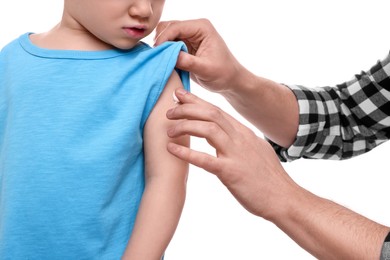 Photo of Father applying ointment onto her son`s shoulder on white background, closeup