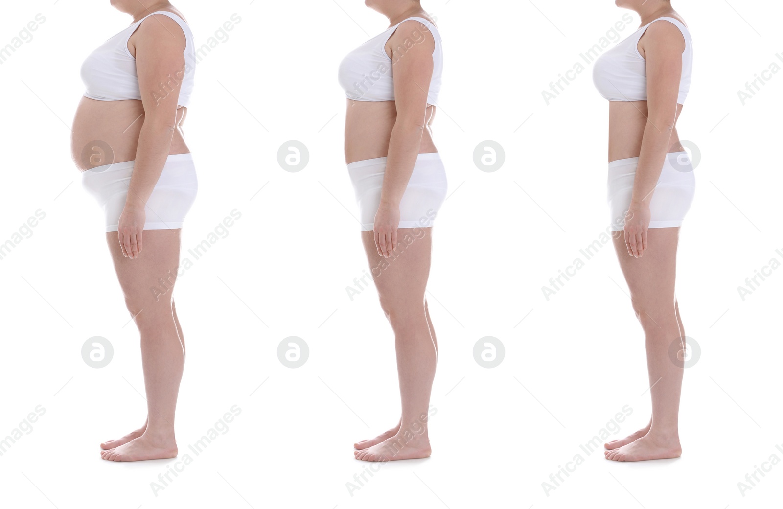 Image of Collage with photos of overweight woman before and after weight loss on white background,closeup