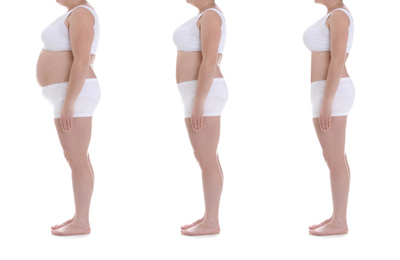 Collage with photos of overweight woman before and after weight loss on white background,closeup