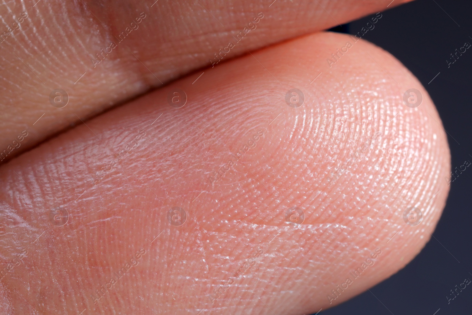 Photo of Macro view of finger with friction ridges